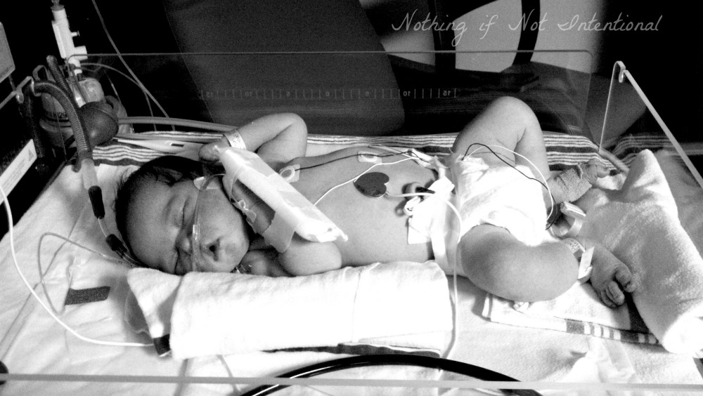 The science of skin-to-skin contact and how it helped our baby in the NICU